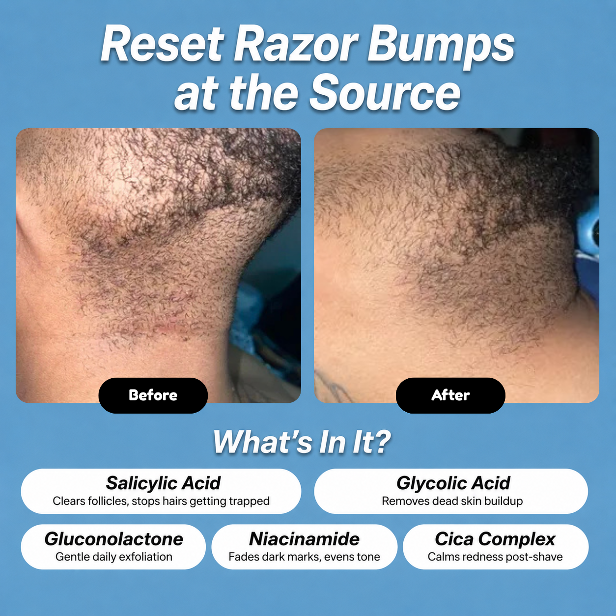 Bump Reset Roll-On
